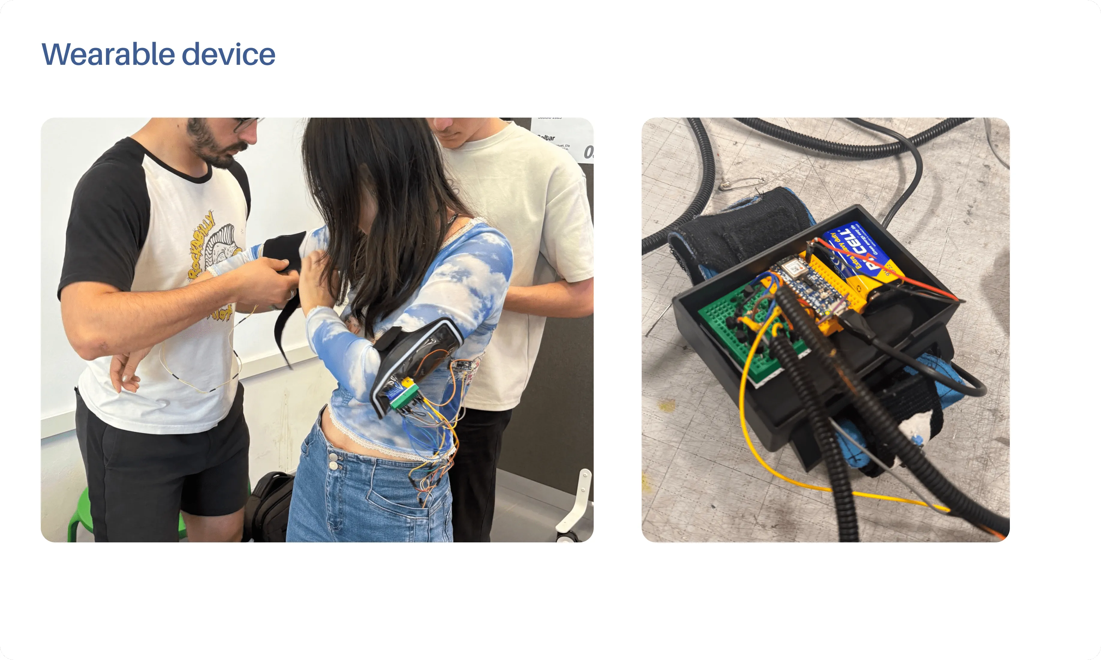 Soltar wearable device view 2